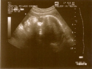 Bean seven month scan